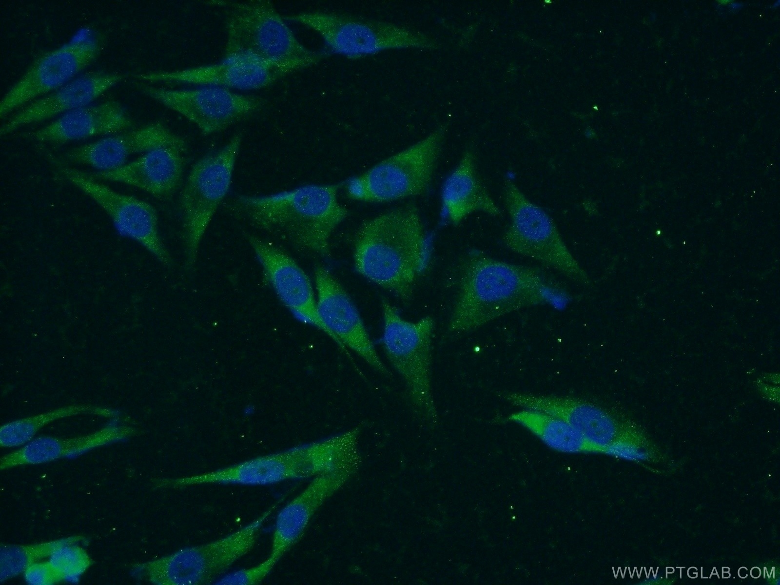 IF Staining of A375 using 18714-1-AP