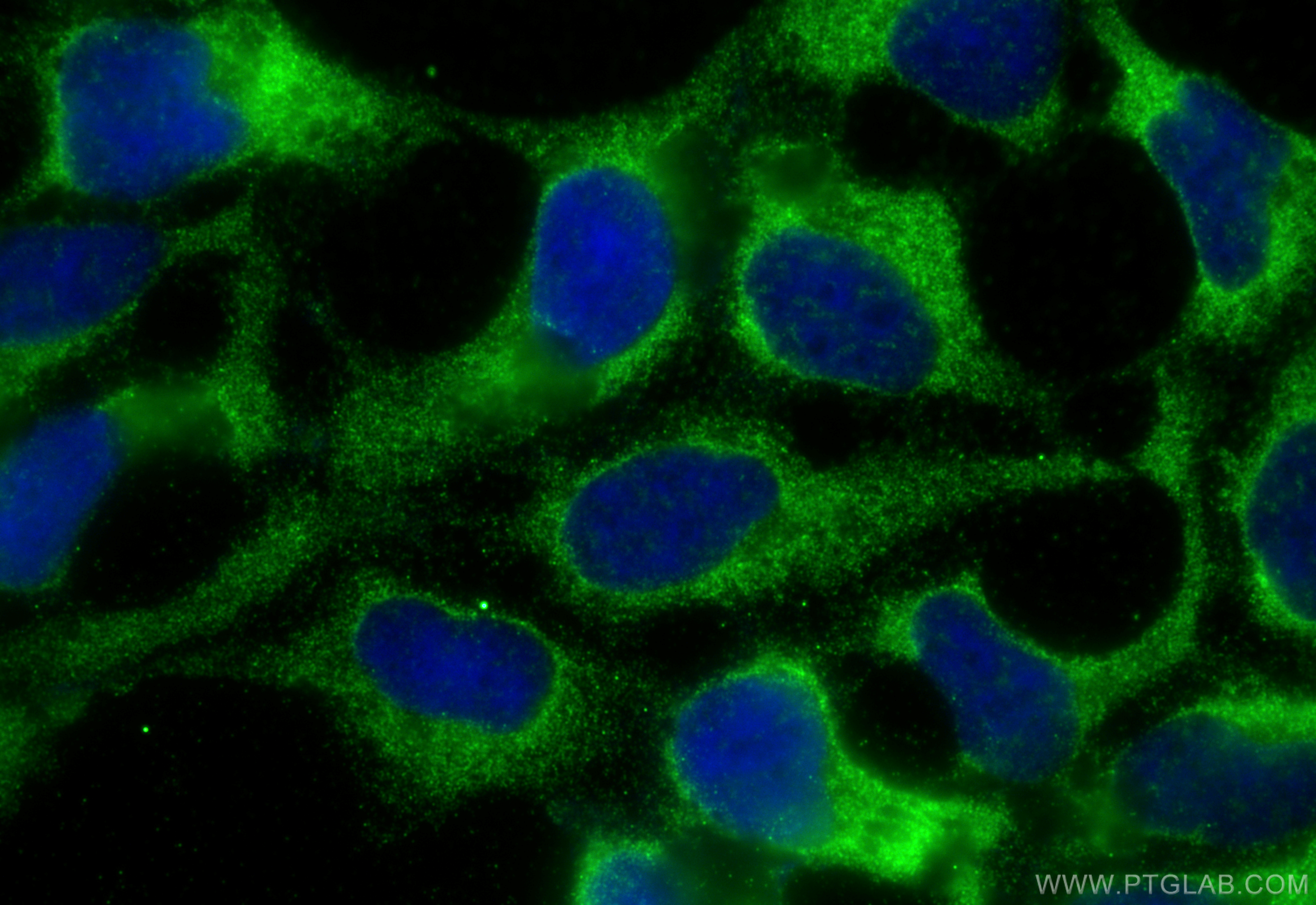 IF Staining of HEK-293 using 18714-1-AP