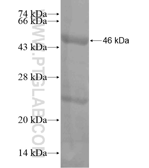 VWA2 fusion protein Ag18883 SDS-PAGE VWA2 fusion protein Ag18883 SDS-PAGE