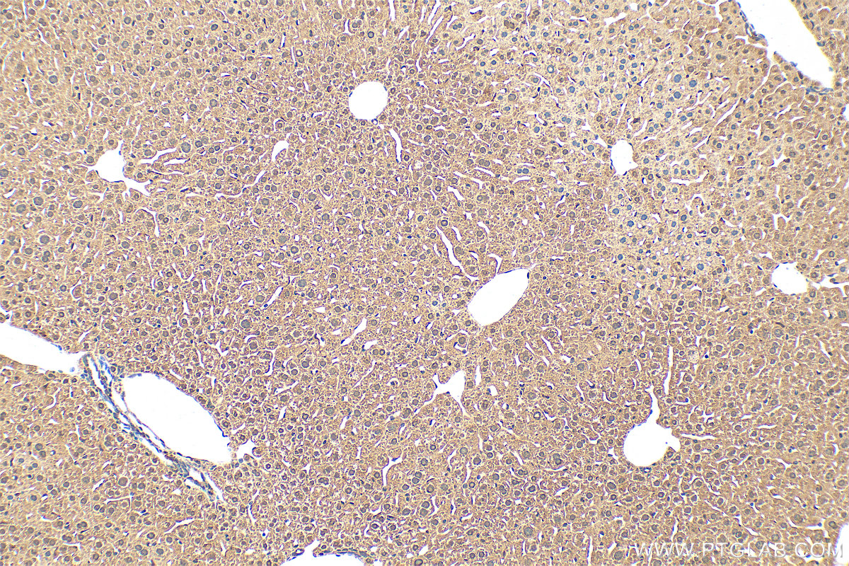IHC staining of mouse liver using 26175-1-AP