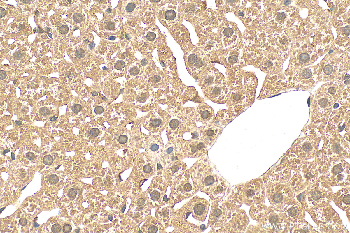 IHC staining of mouse liver using 26175-1-AP
