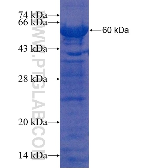 VWA5A fusion protein Ag22010 SDS-PAGE