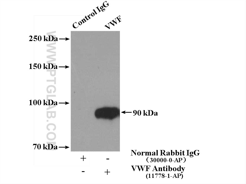 IP experiment of mouse spleen using 11778-1-AP