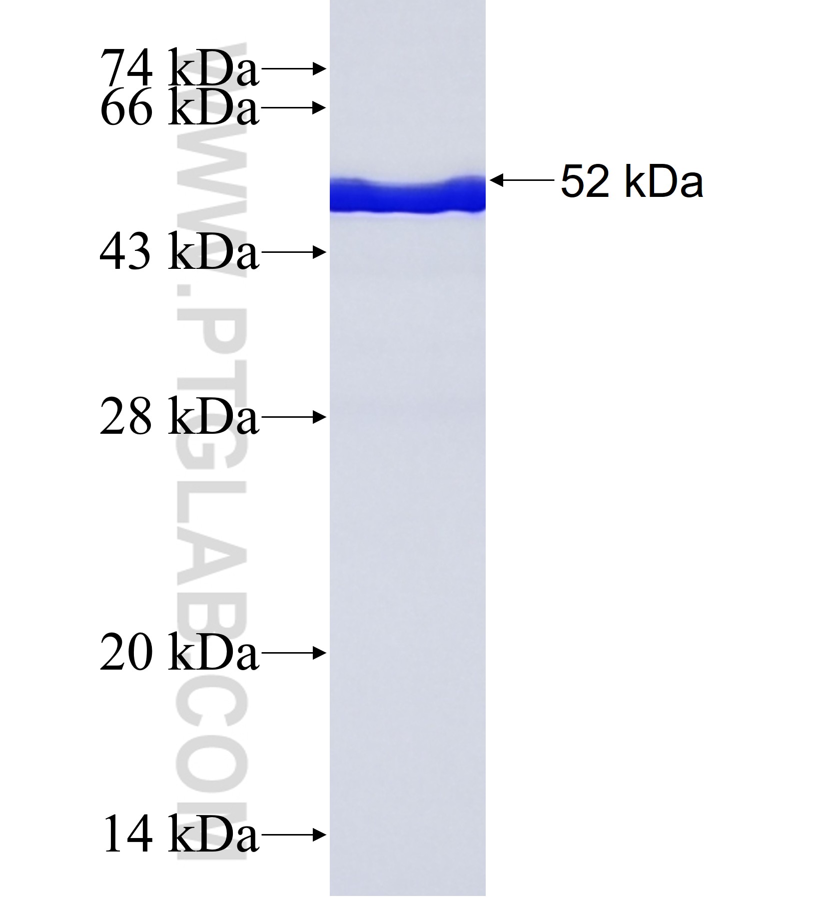 VWF fusion protein Ag41963 SDS-PAGE VWF fusion protein Ag41963 SDS-PAGE