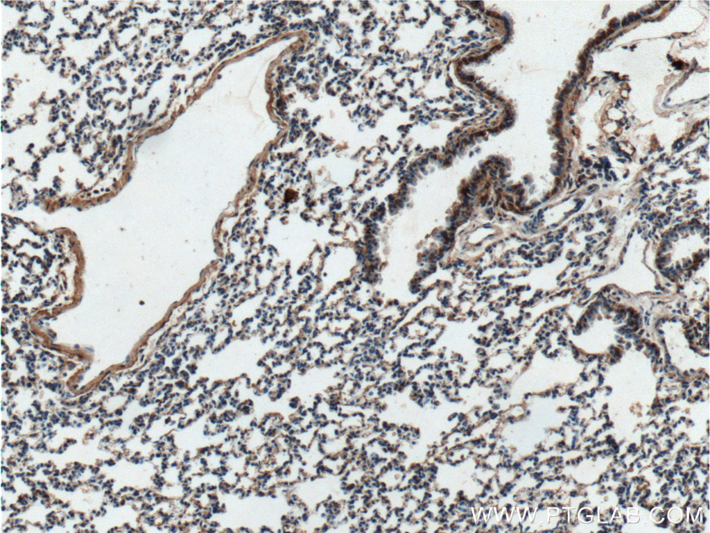 IHC staining of mouse lung using 26157-1-AP