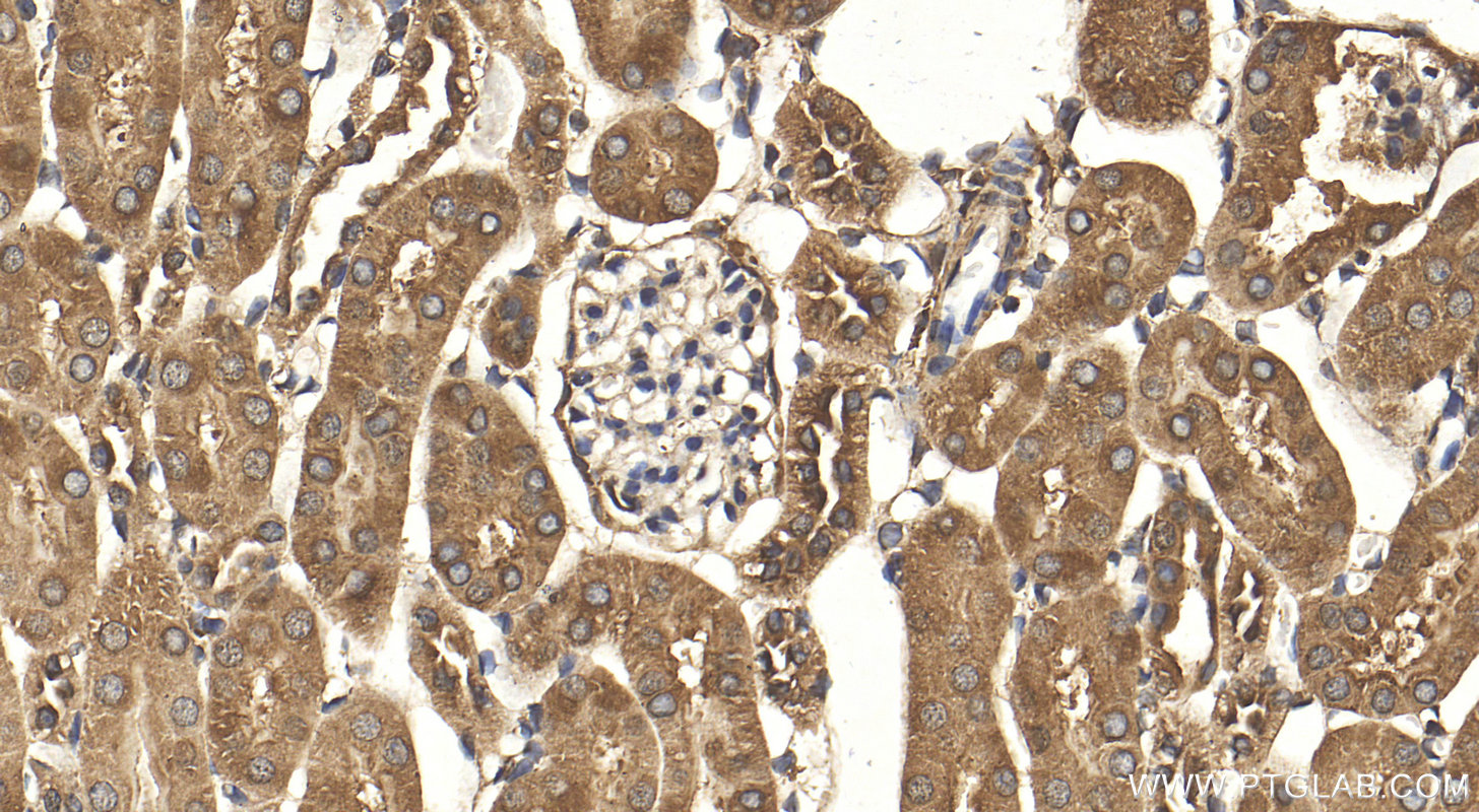 IHC staining of mouse kidney using 26157-1-AP