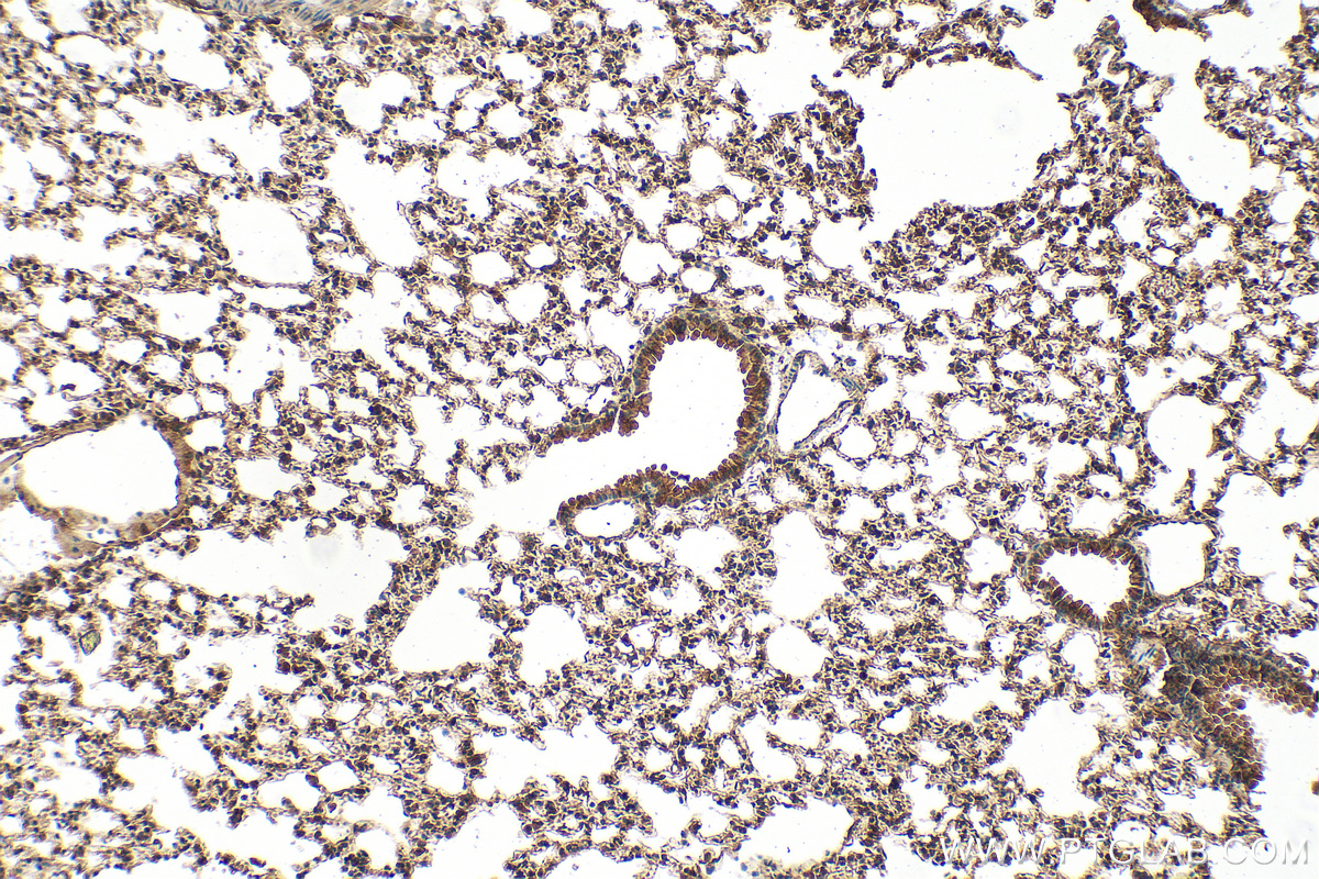 Immunohistochemical analysis of paraffin-embedded mouse lung tissue slide using 26157-1-AP (VEGFA antibody) at dilution of 1:200 (under 10x lens). Heat mediated antigen retrieval with Tris-EDTA buffer (pH 9.0). IHC staining of mouse lung using 26157-1-AP