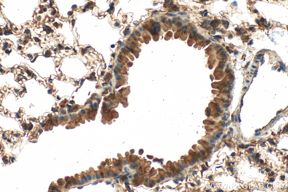 Immunohistochemical analysis of paraffin-embedded mouse lung tissue slide using 26157-1-AP (VEGFA antibody) at dilution of 1:200 (under 40x lens). Heat mediated antigen retrieval with Tris-EDTA buffer (pH 9.0). IHC staining of mouse lung using 26157-1-AP