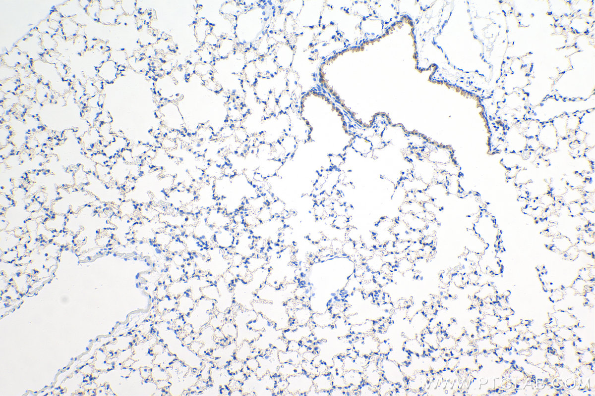 IHC staining of mouse lung using 82864-7-RR (same clone as 82864-7-PBS)
