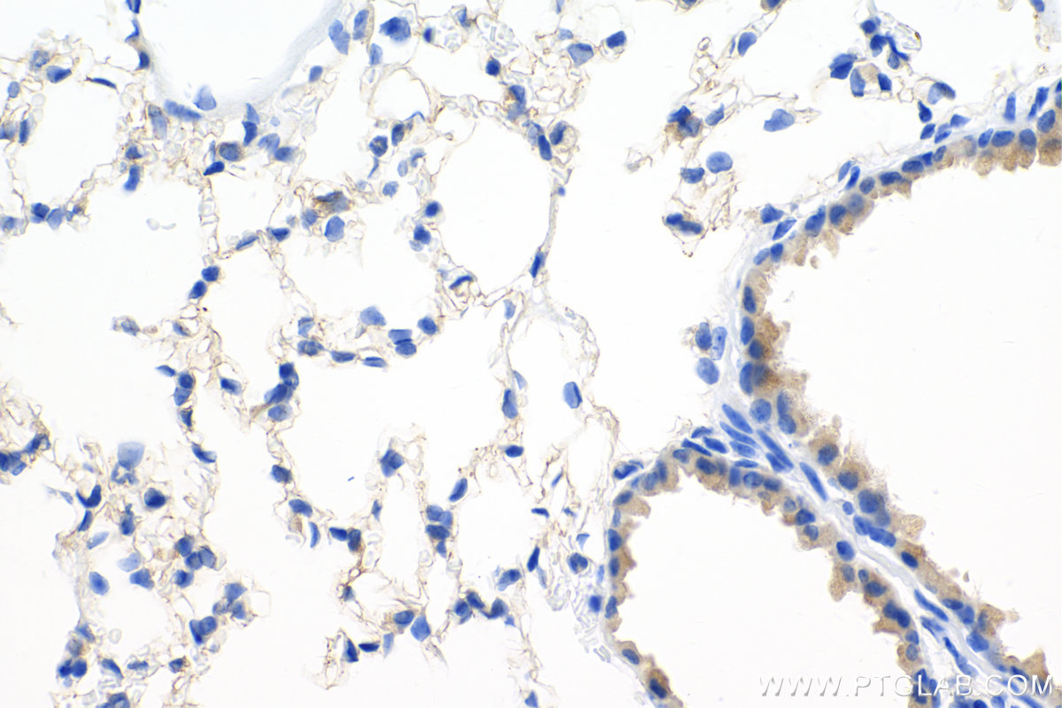 IHC staining of mouse lung using 82864-7-RR (same clone as 82864-7-PBS)