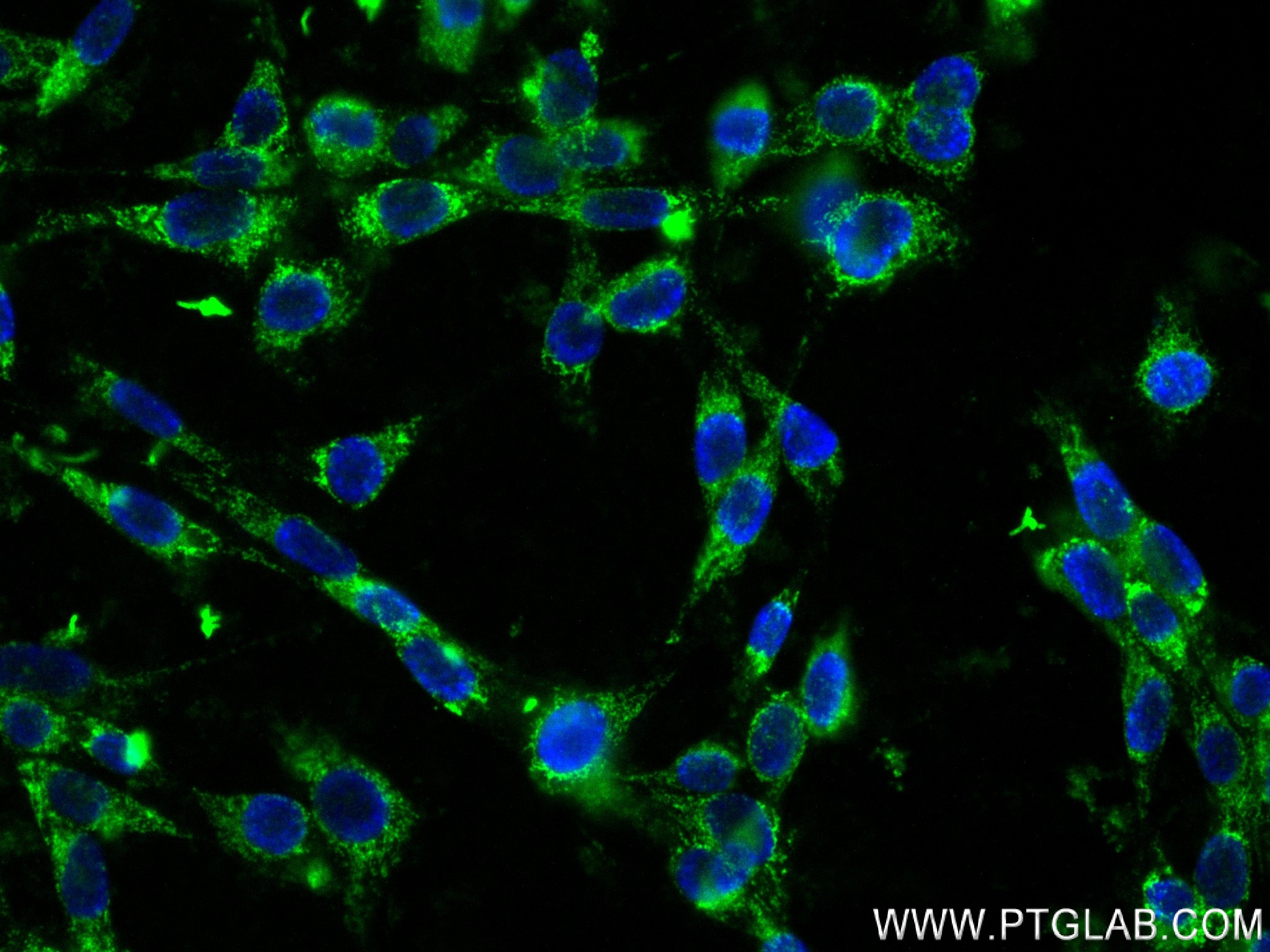 IF Staining of NIH/3T3 using 82864-9-RR (same clone as 82864-9-PBS)
