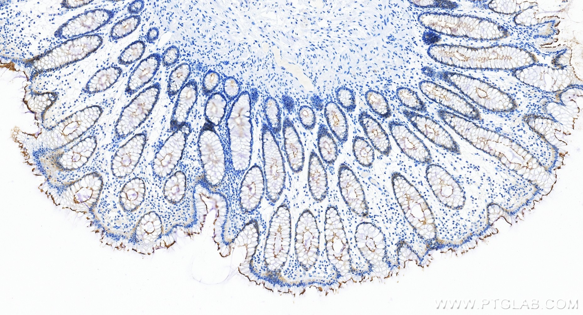 IHC staining of human colon using 86978-2-RR IHC staining of human colon using 86978-2-RR