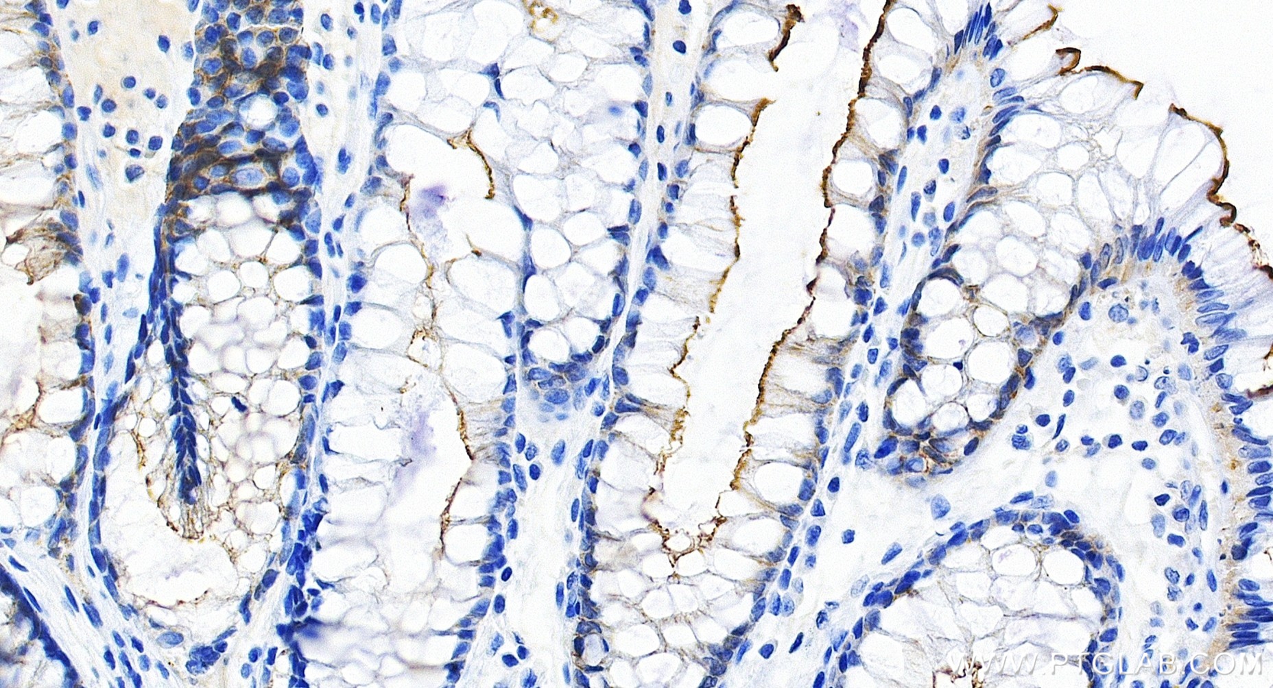 IHC staining of human colon using 86978-2-RR IHC staining of human colon using 86978-2-RR