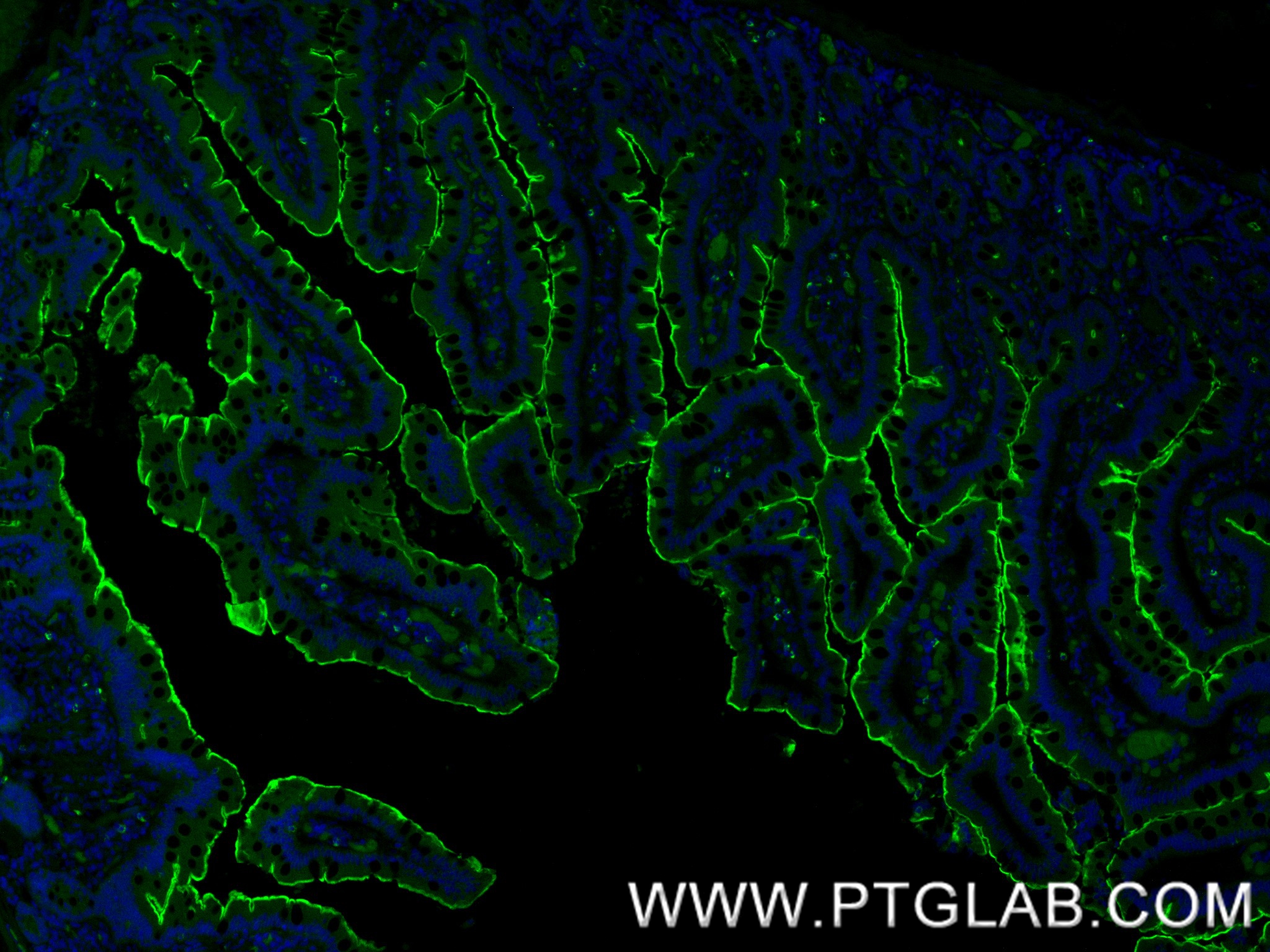 IF Staining of human small intestine using 86978-2-RR IF Staining of human small intestine using 86978-2-RR