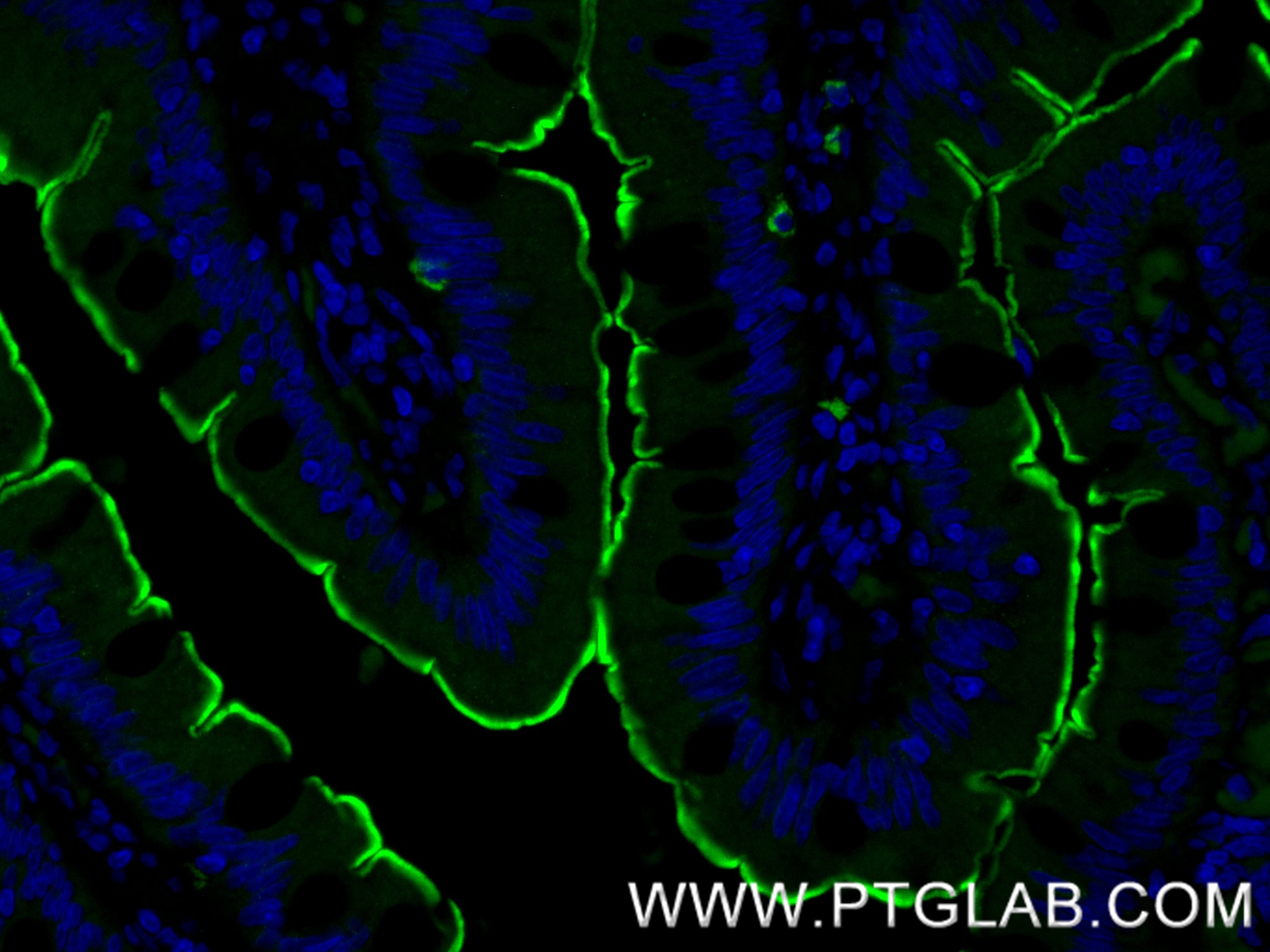 IF Staining of human small intestine using 86978-2-RR IF Staining of human small intestine using 86978-2-RR