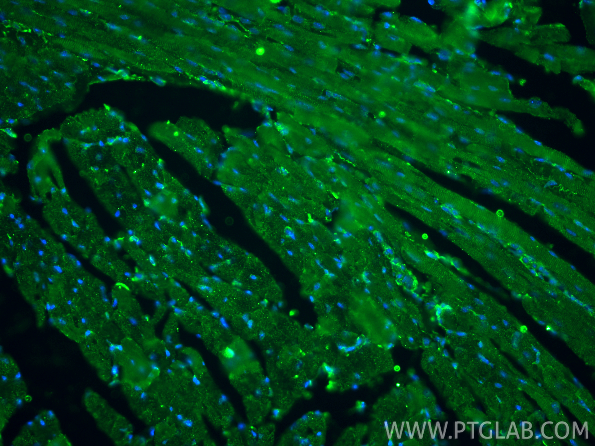 IF Staining of Customer Sample using 60330-1-Ig