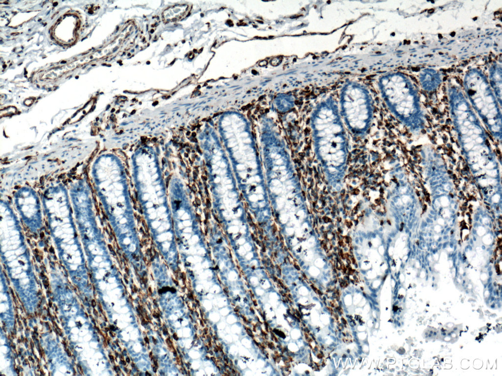 IHC staining of human colon using 60330-1-Ig (same clone as 60330-1-PBS)
