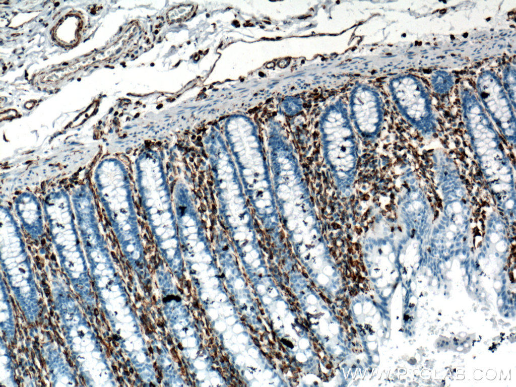 IHC staining of human colon using 60330-1-Ig