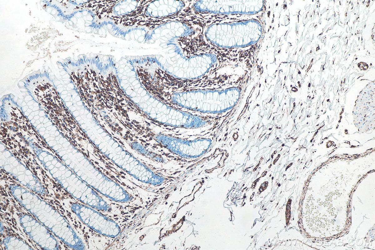 IHC staining of human colon using 60330-1-Ig IHC staining of human colon using 60330-1-Ig