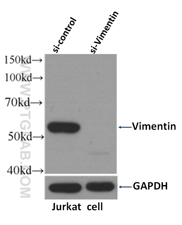 WB analysis of Jurkat cells using 60330-1-Ig (same clone as 60330-1-PBS)