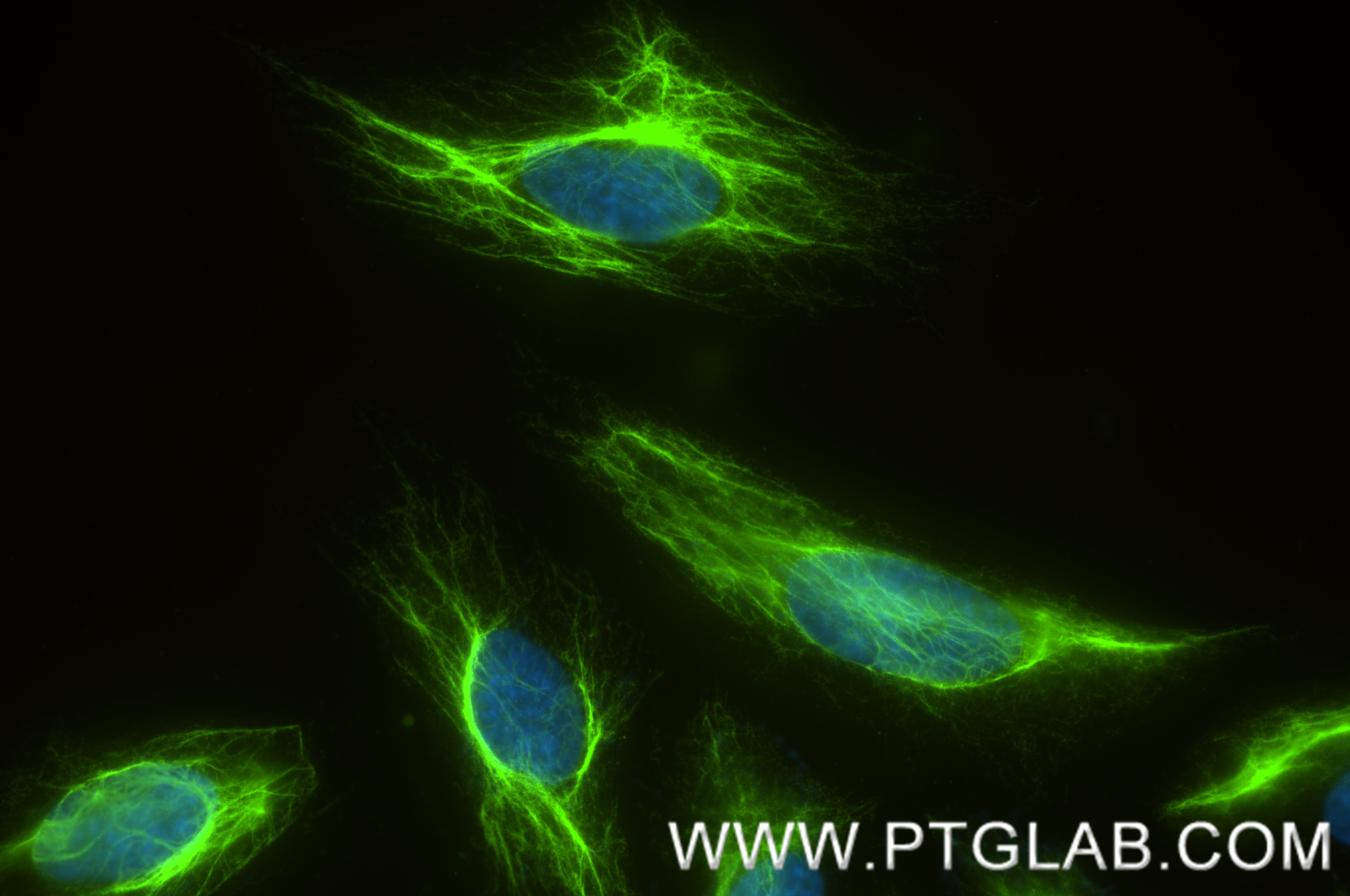 IF Staining of HeLa using 80232-1-RR