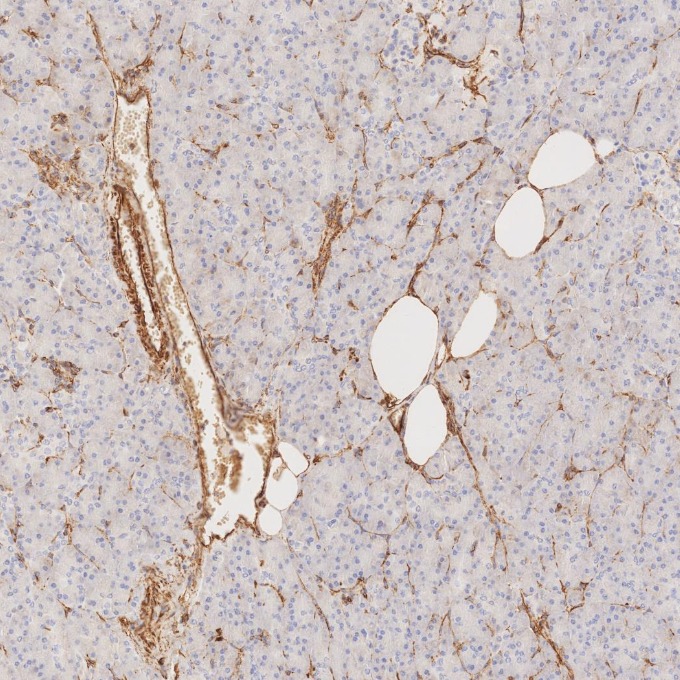 IHC staining of human pancreas using 80232-1-RR