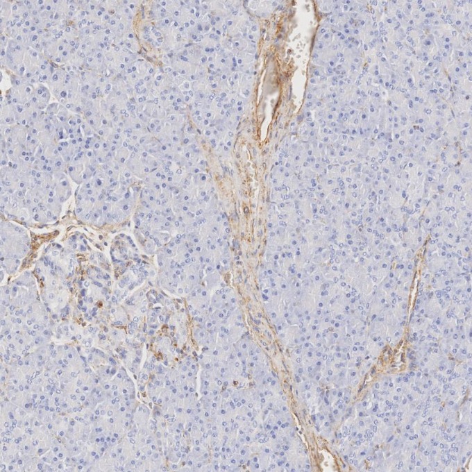 IHC staining of human pancreas using 80232-1-RR