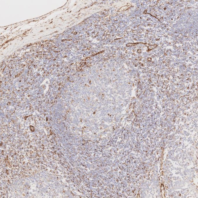IHC staining of human tonsillitis using 80232-1-RR