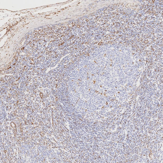 IHC staining of human tonsillitis using 80232-1-RR