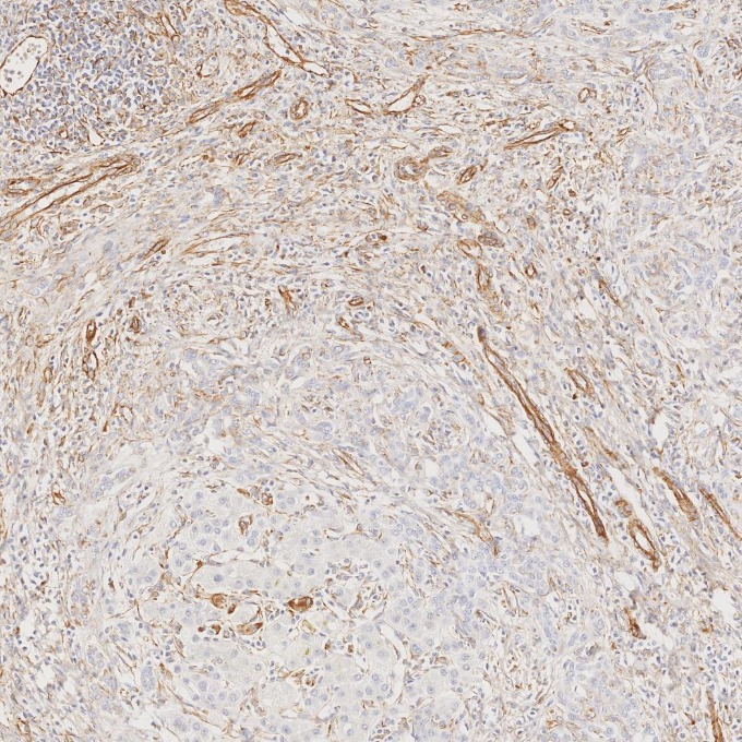 IHC staining of human liver using 80232-1-RR