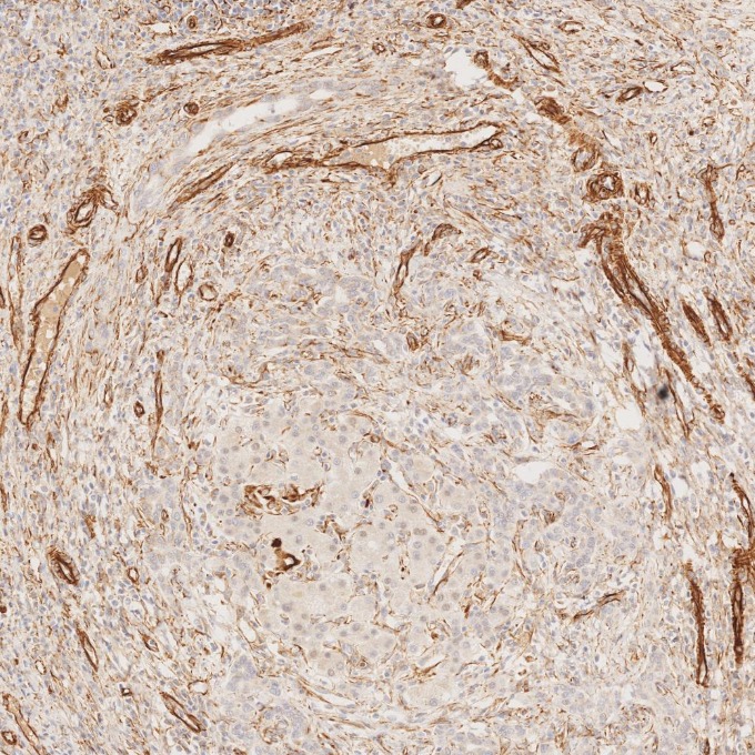 IHC staining of human liver using 80232-1-RR