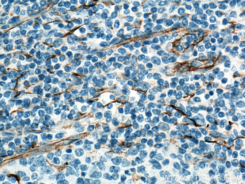 IHC staining of human tonsillitis using Biotin-60330