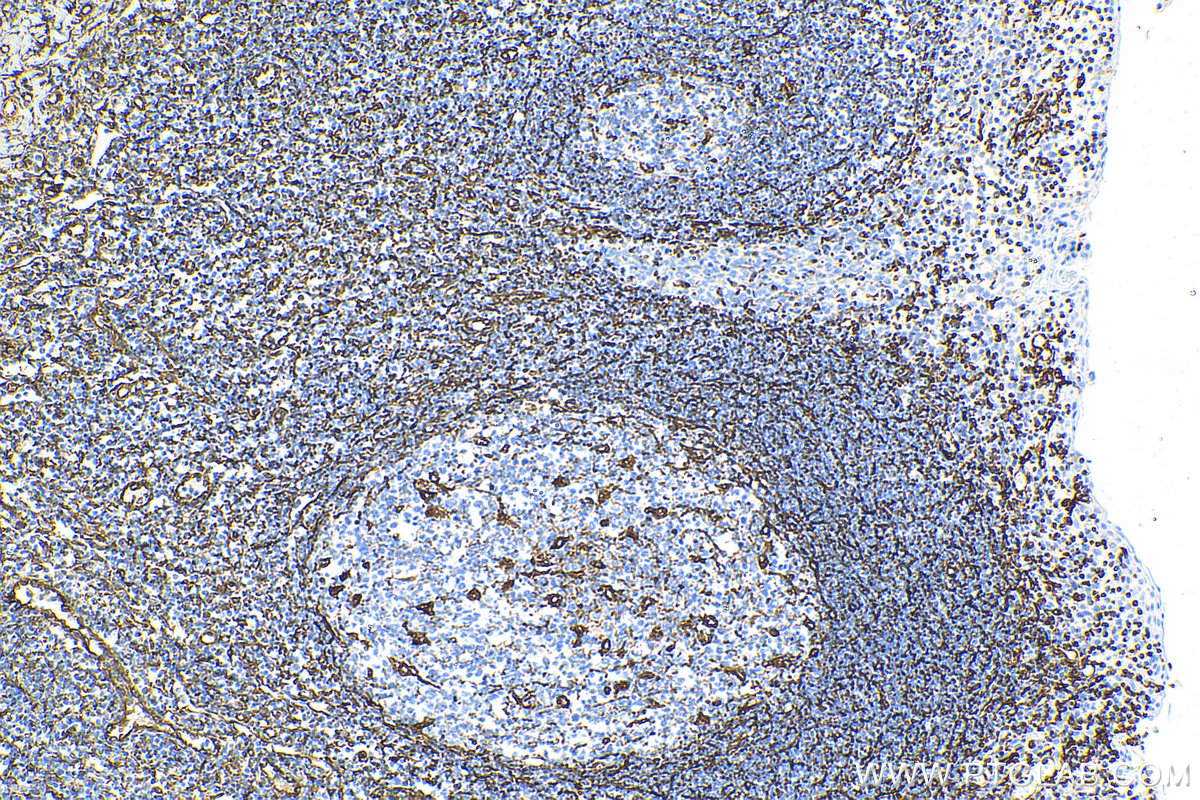 IHC staining of human tonsillitis using Biotin-60330