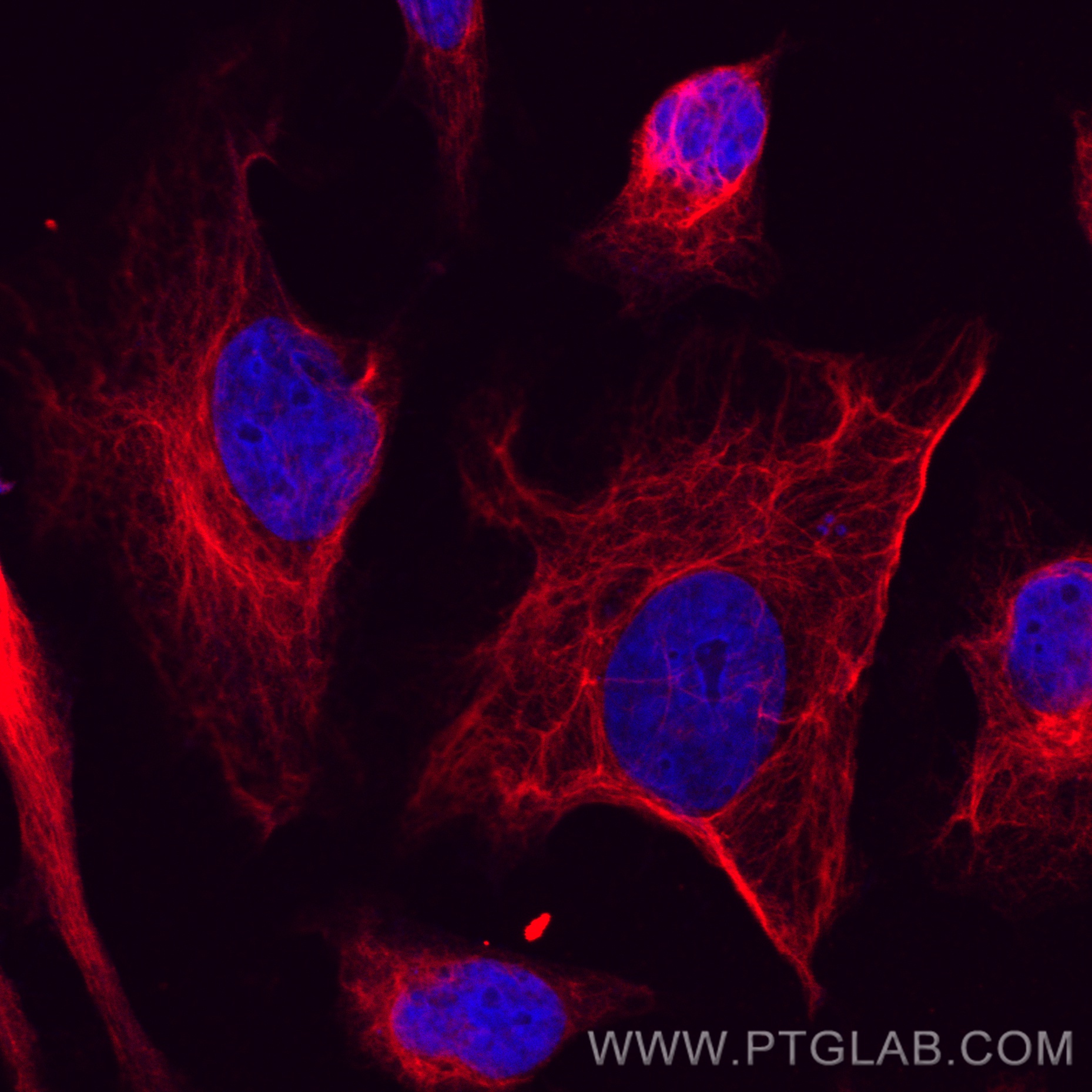 IF Staining of HeLa using CL594-80232