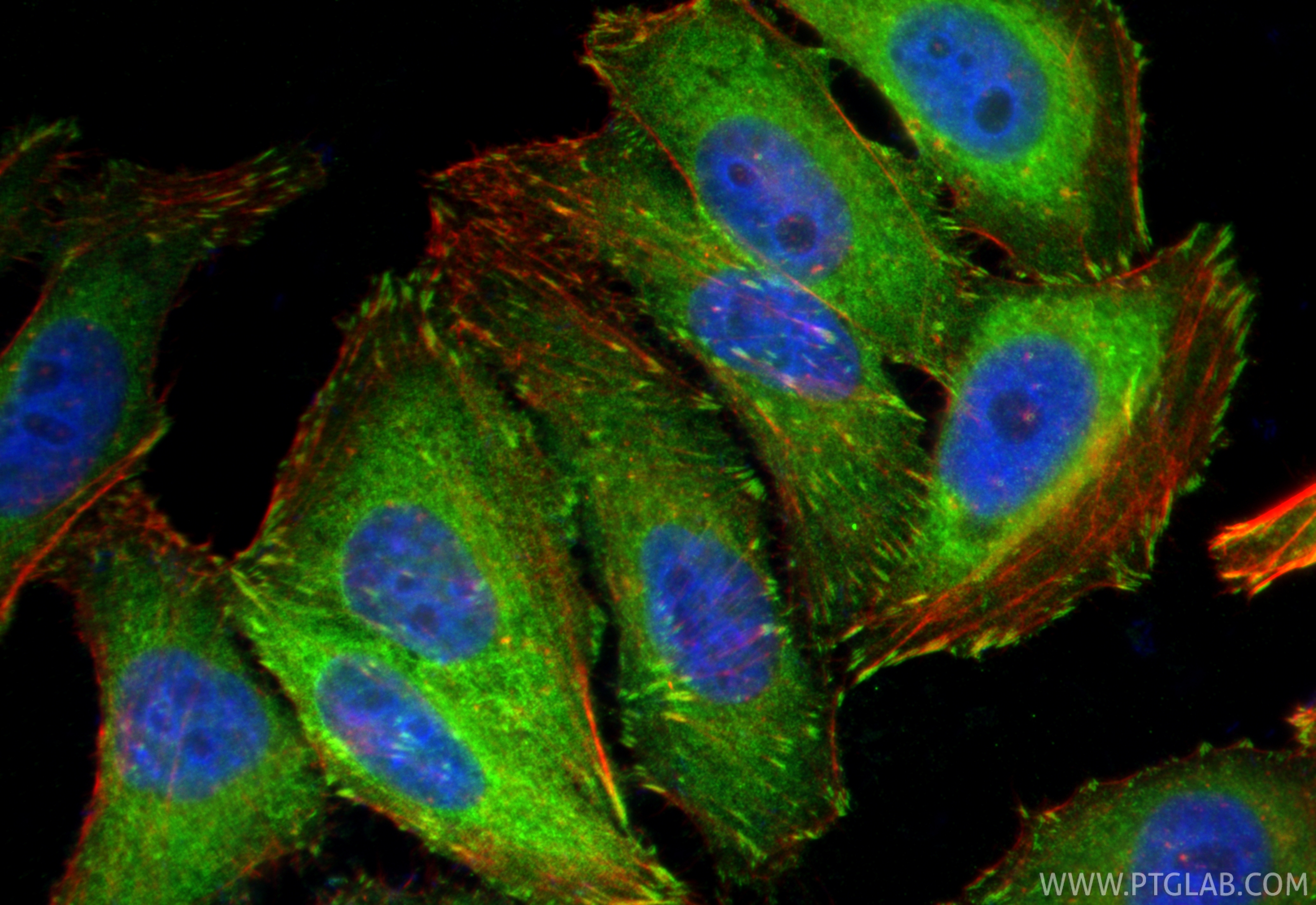 IF Staining of HepG2 using 26520-1-AP