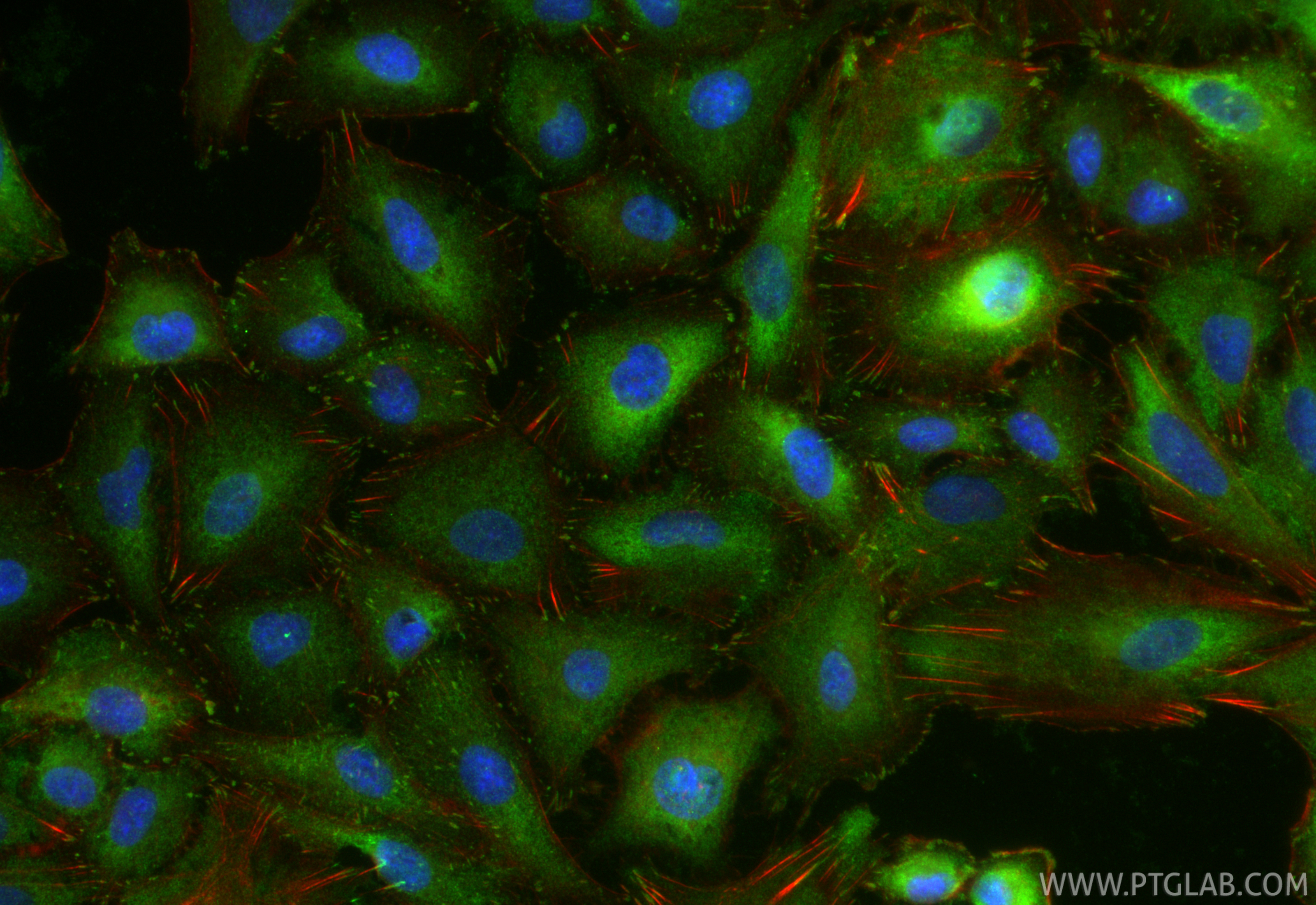 IF Staining of A549 using 26520-1-AP IF Staining of A549 using 26520-1-AP