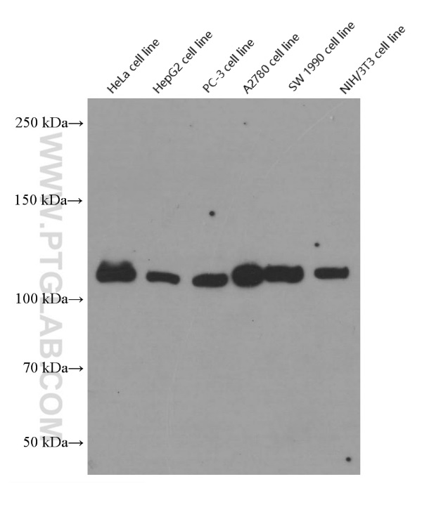 Vinculin Monoclonal antibody