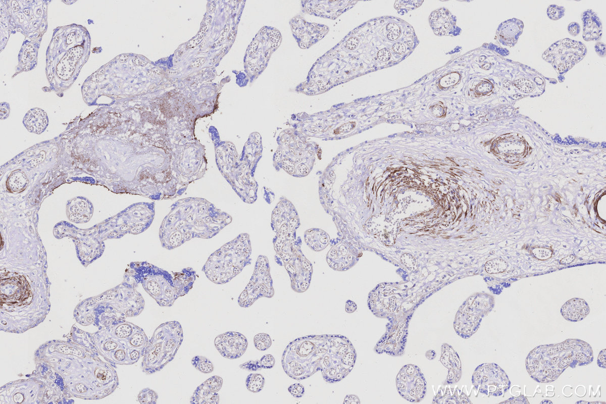 IHC staining of human placenta using 66305-2-Ig IHC staining of human placenta using 66305-2-Ig
