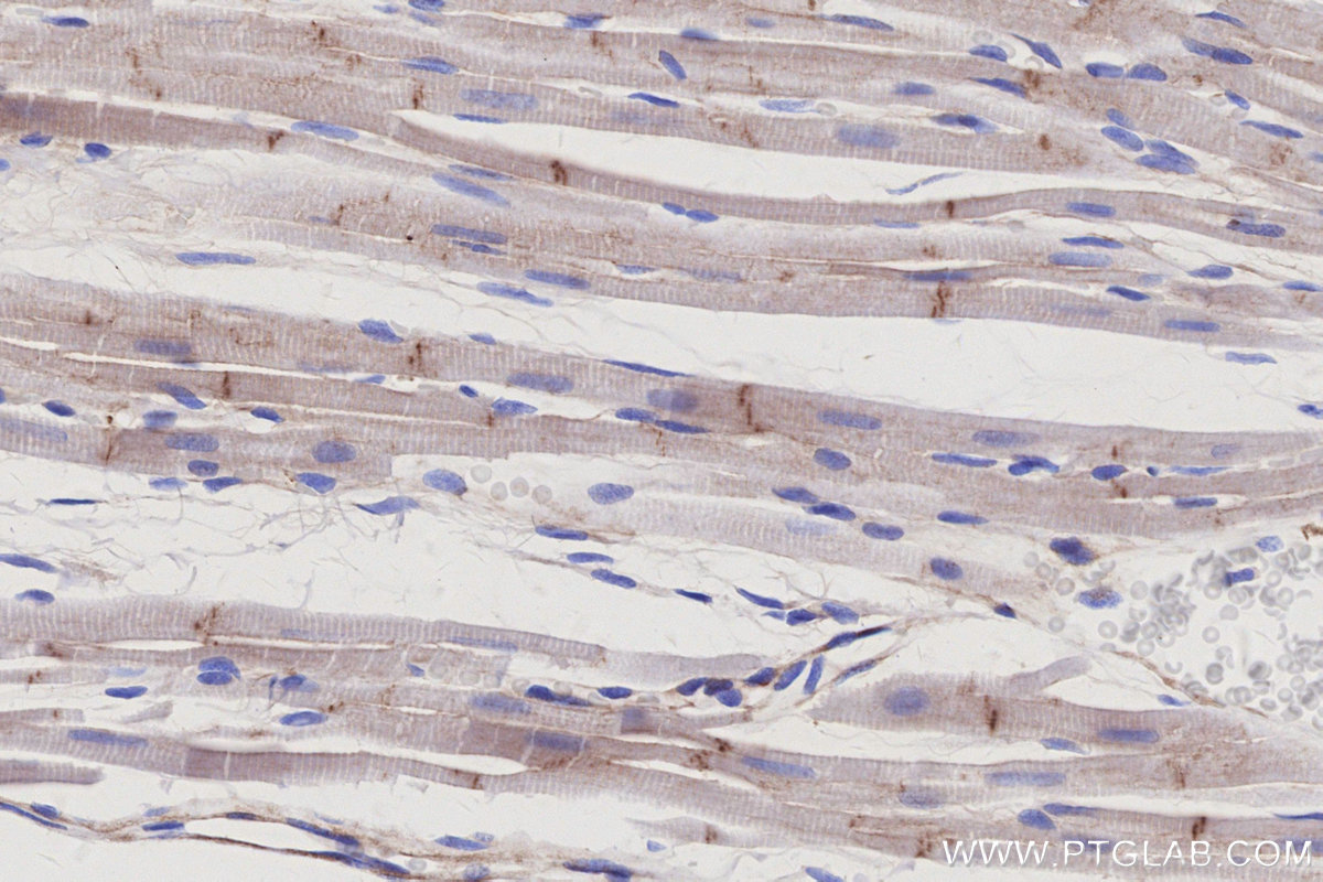 IHC staining of rat heart using 66305-2-Ig IHC staining of rat heart using 66305-2-Ig