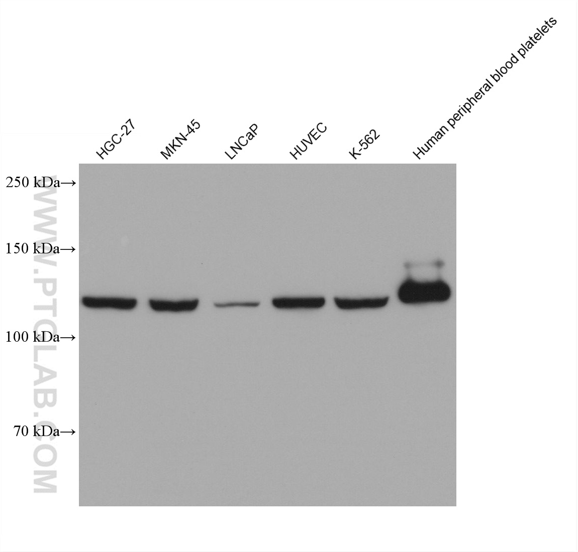 WB analysis using 66305-2-Ig