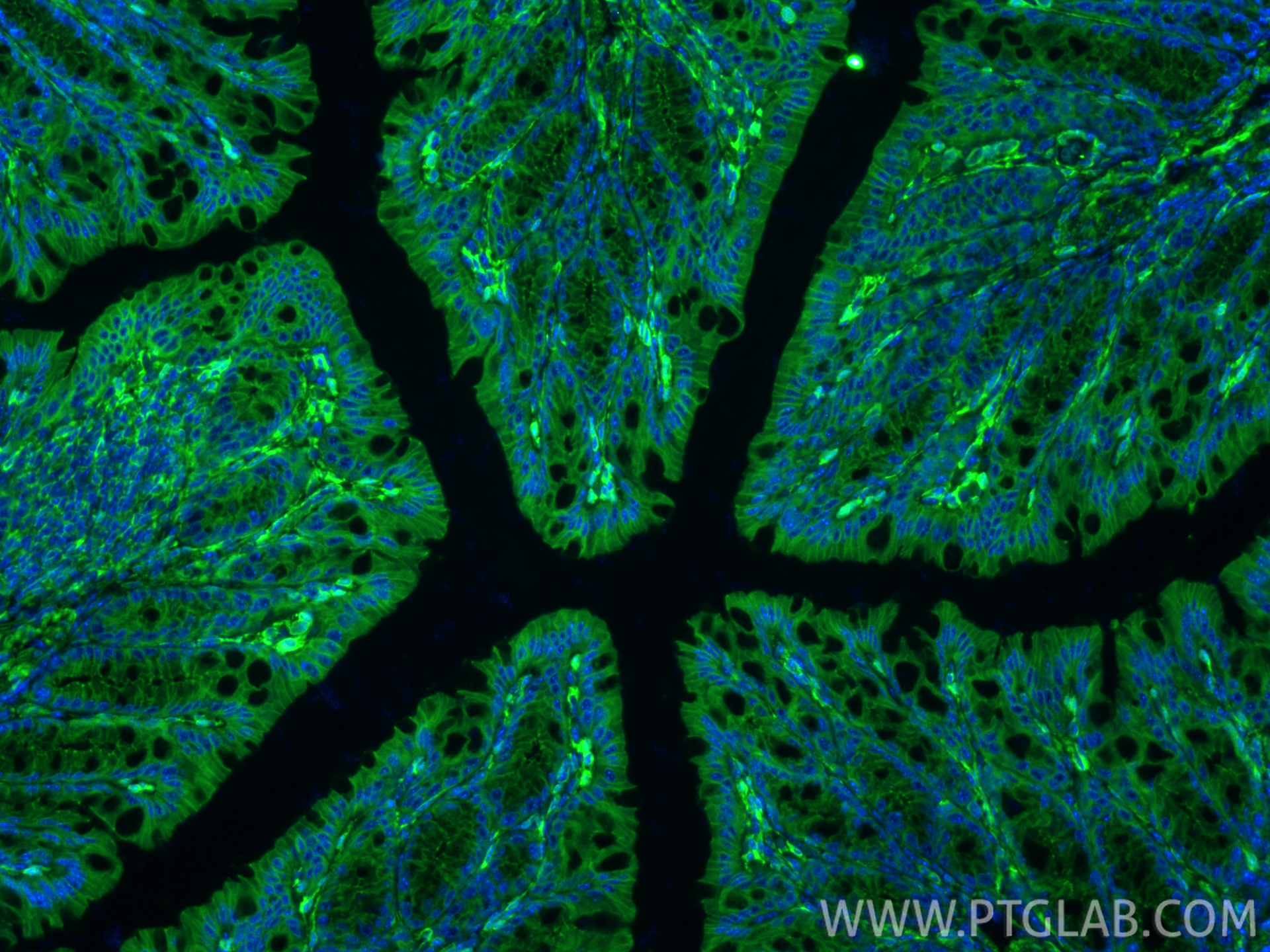 IF Staining of mouse colon using 86930-1-RR