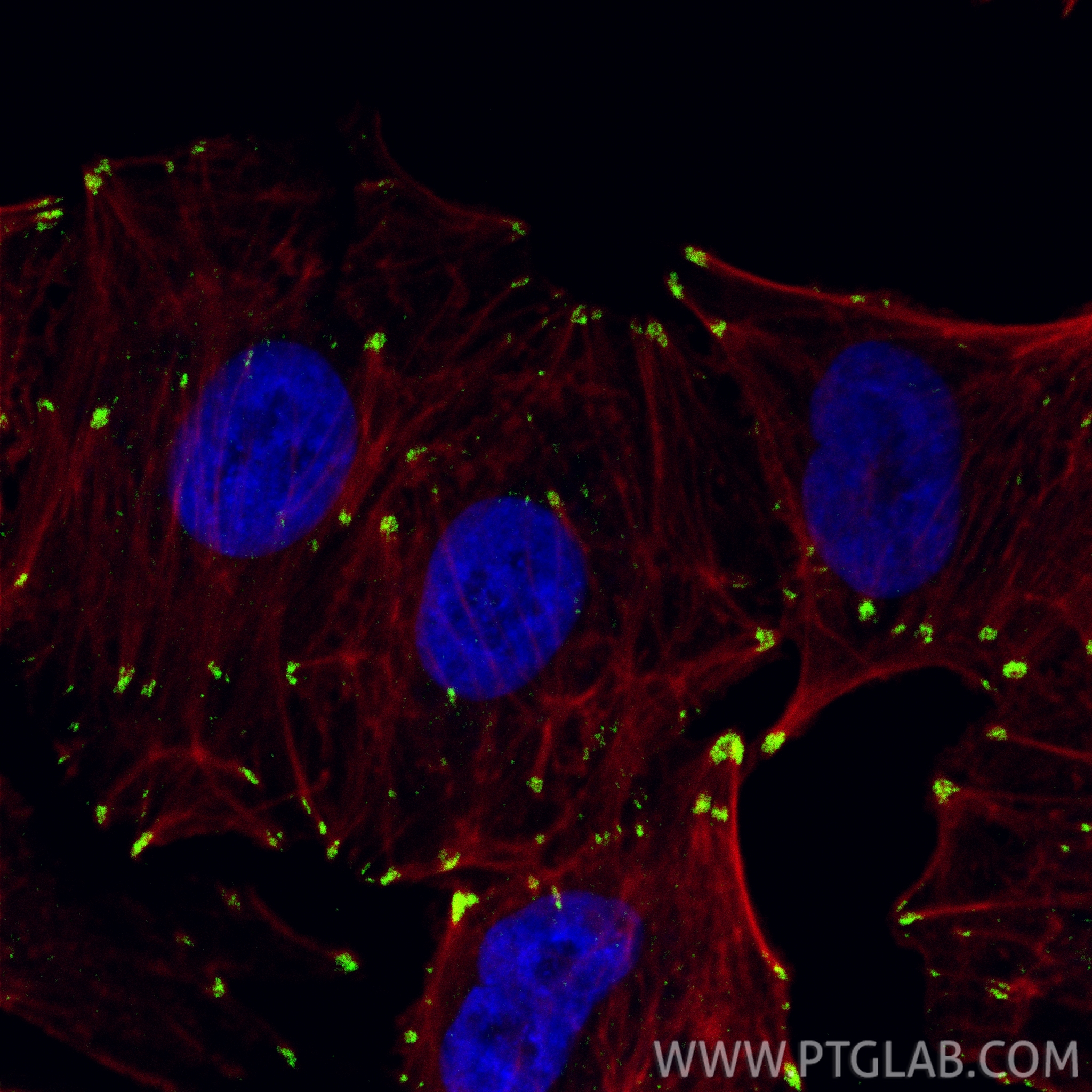 IF Staining of A549 using 86930-1-RR IF Staining of A549 using 86930-1-RR