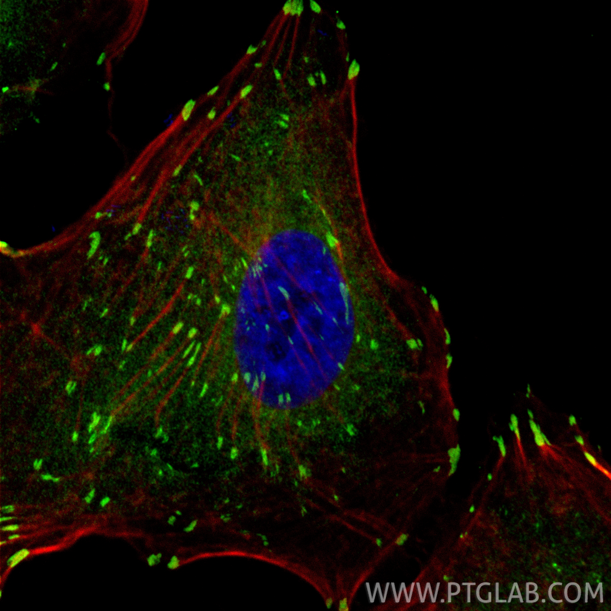 IF Staining of A549 using CL488-26520 IF Staining of A549 using CL488-26520