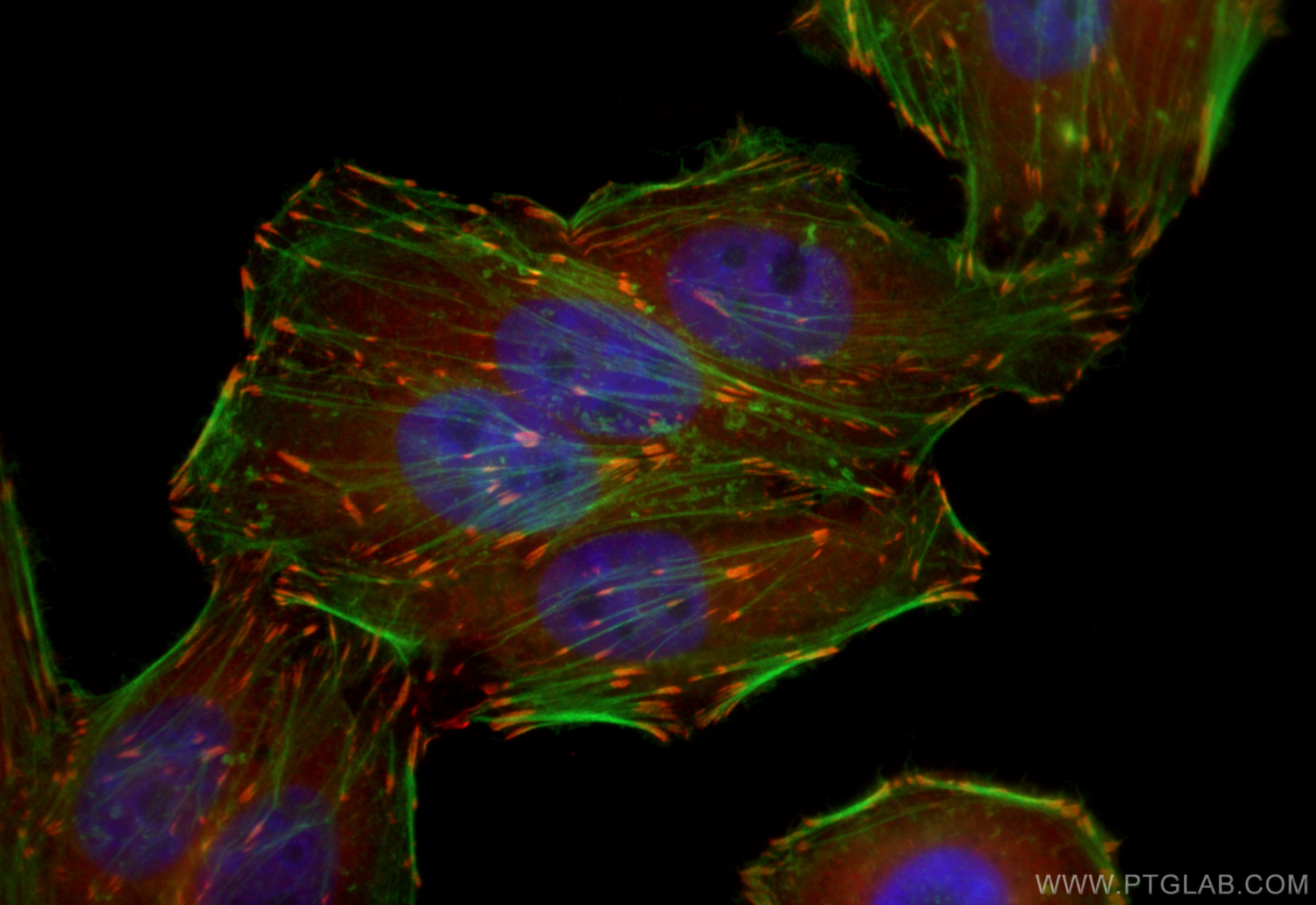 IF Staining of HepG2 using CL594-26520