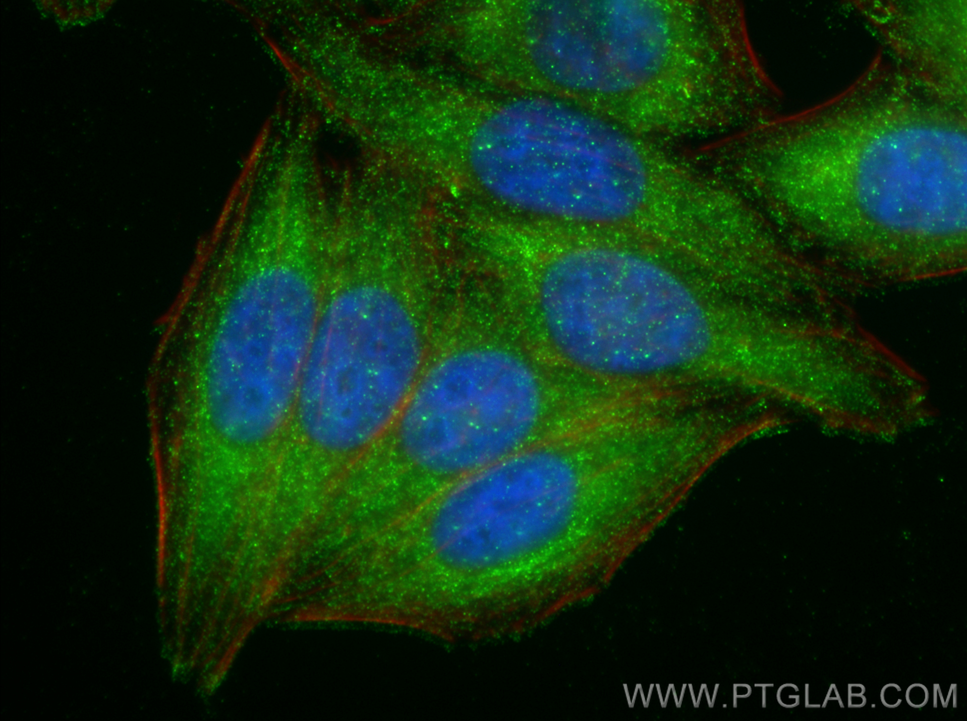 IF Staining of HepG2 using 66175-1-Ig