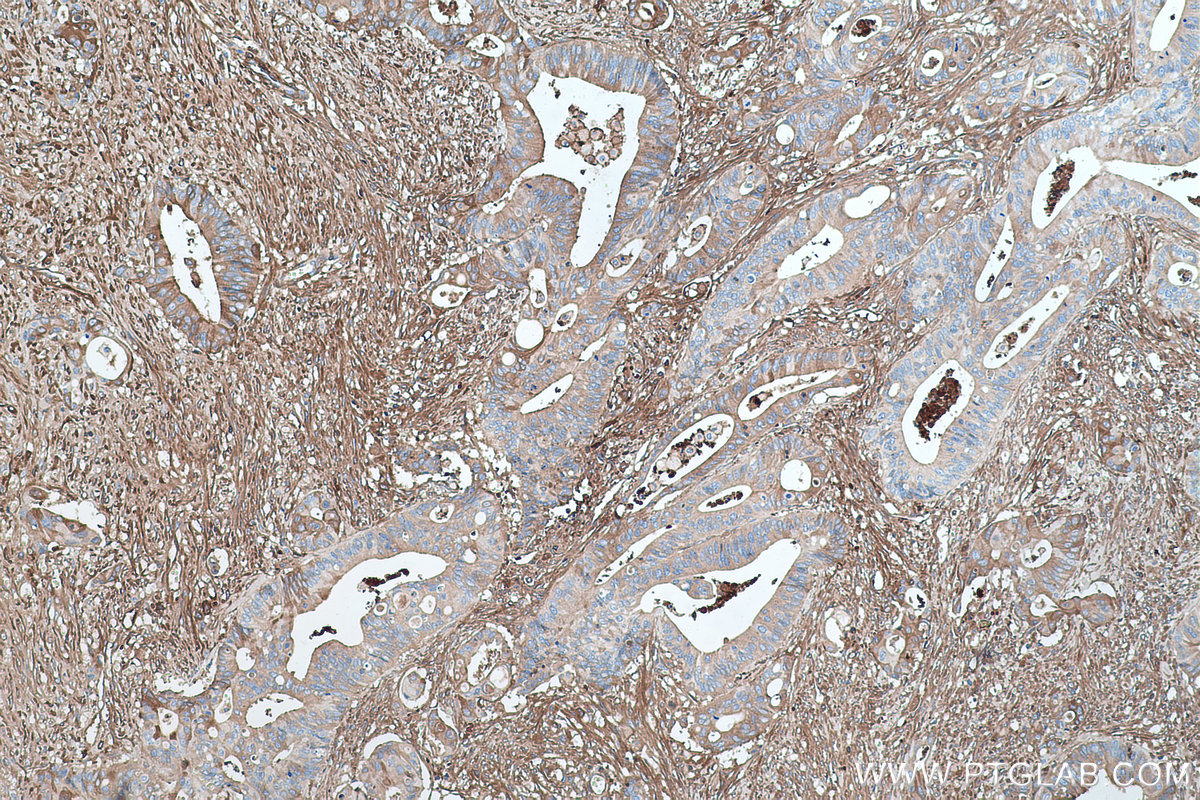 Vitamin D binding protein
