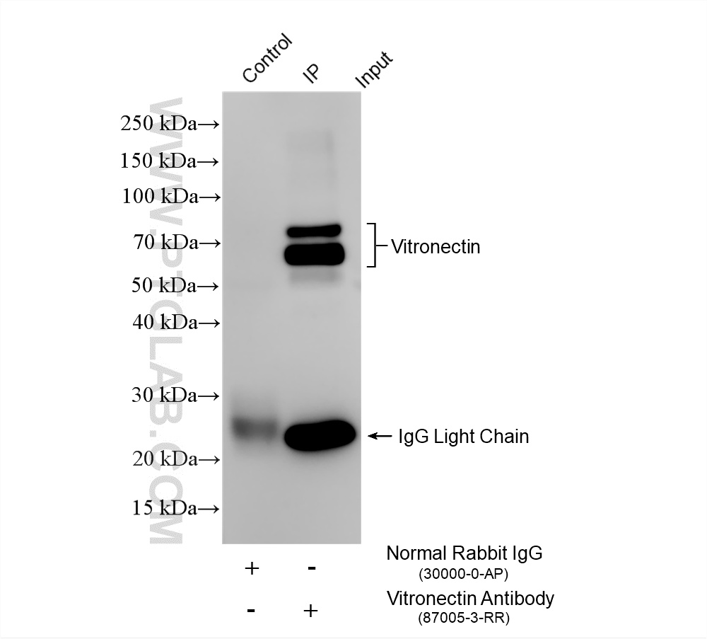IP experiment of human plasma using 87005-3-RR (same clone as 87005-3-PBS) IP experiment of human plasma using 87005-3-RR (same clone as 87005-3-PBS)