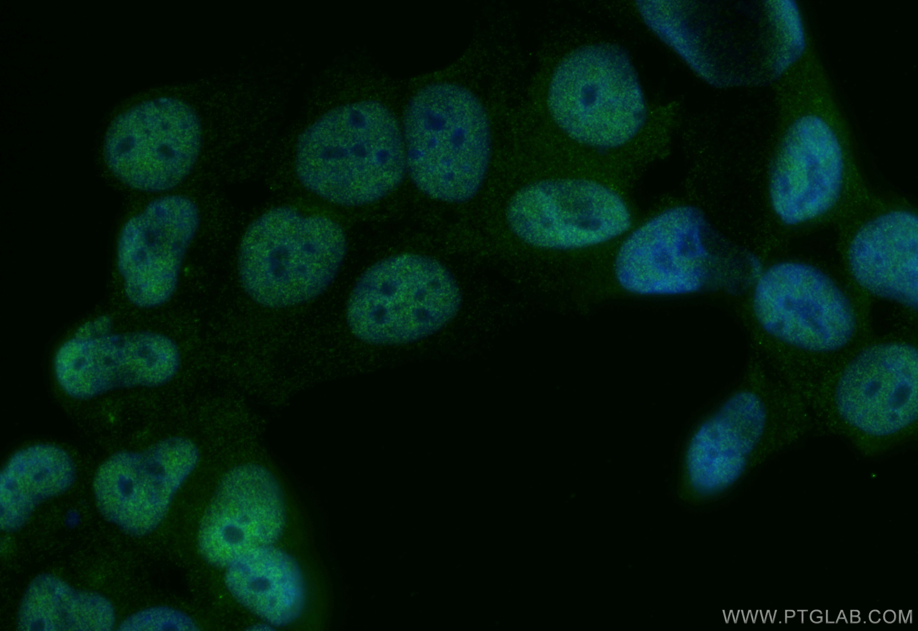 IF Staining of MCF-7 using 20519-1-AP