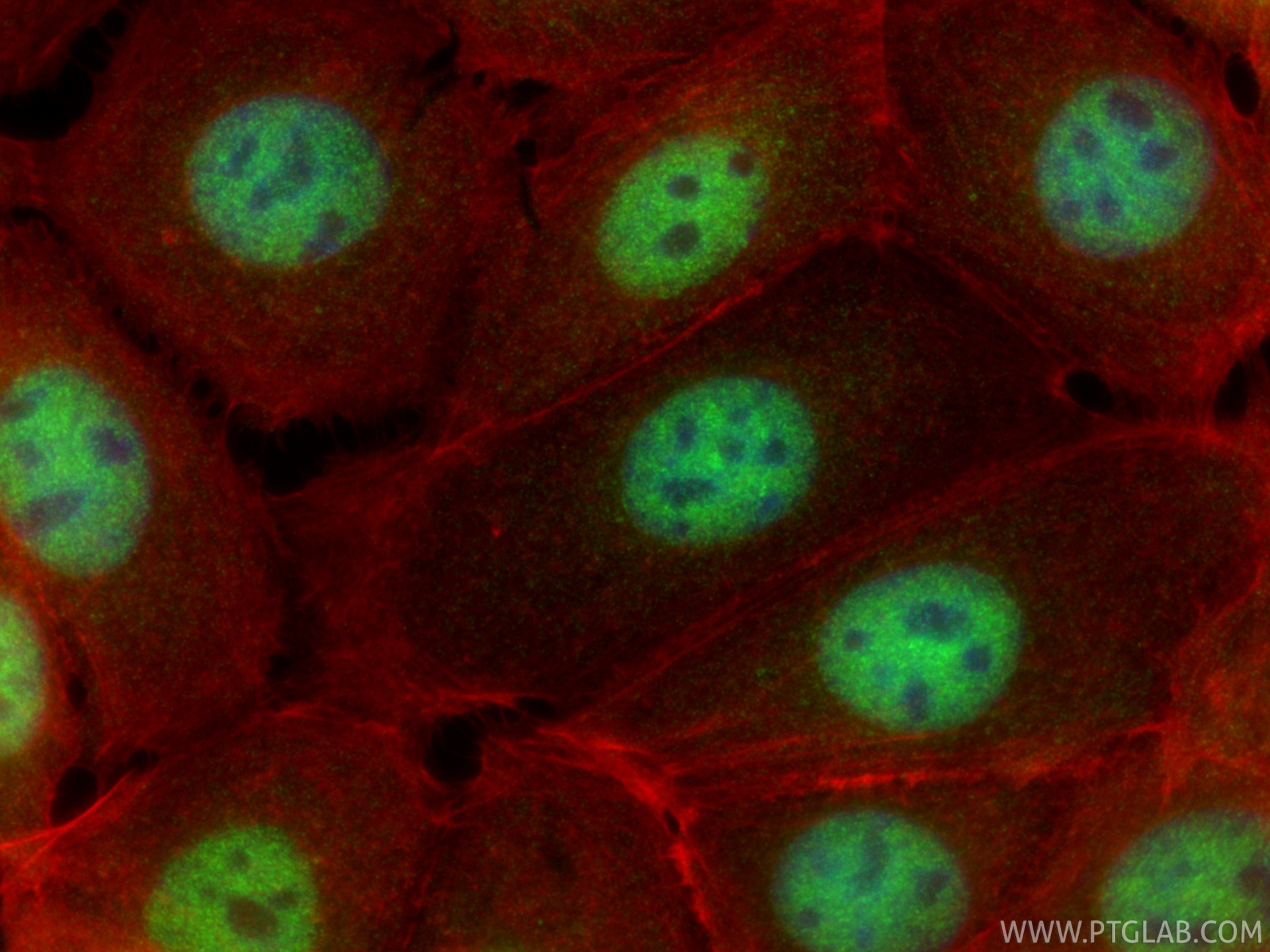 IF Staining of MCF-7 using 20519-1-AP IF Staining of MCF-7 using 20519-1-AP