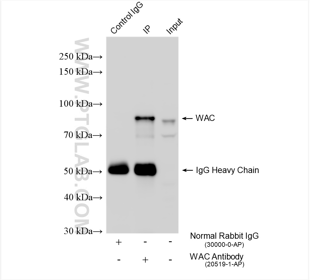IP experiment of HeLa using 20519-1-AP